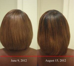 biotin hair growth